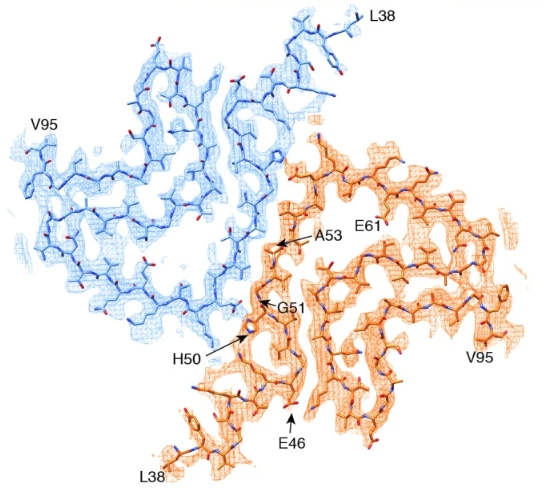 A53T Alpha Synuclein in Parkinson’s Disease