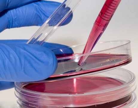 NK cells using factor in vitro culture