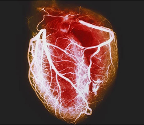 Research experts use induced pluripotent stem cells (iPSCs) to treat heart disease