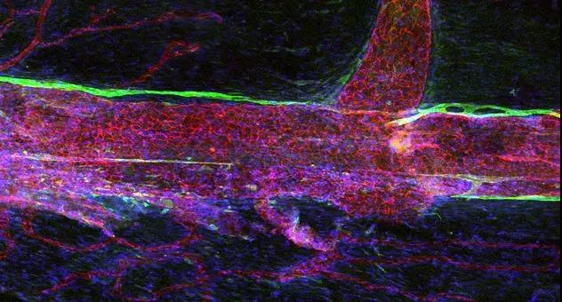 Research reveals new features of meningeal lymphatics