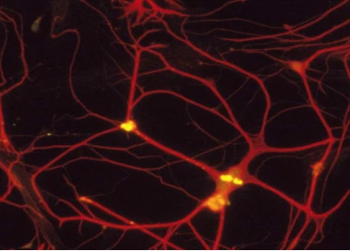 Studies have found that Miller glial cells can regenerate nerve cells in the retina