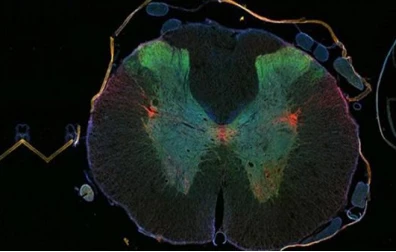 Studies have found that PARP inhibitors can alleviate amyotrophic lateral sclerosis