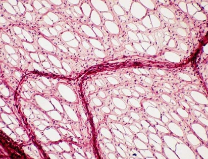 Studies have found that mitochondrial ROS affects muscle differentiation through cellular autophagy