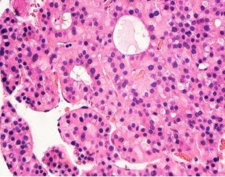 Studies have found that novel cellular mechanisms can be used to target tumor tissue