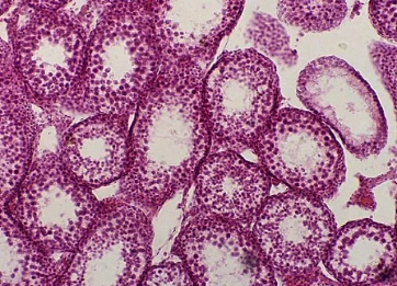 Studies have found that special cancer cells may help reveal tumor cell complications and causes of mutation