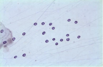Studies have shown that immune cells from mast cells seem to play an important role in animal behavior