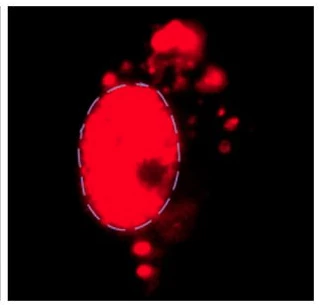 Studies have shown that inhibition of RIPK1 activity can reduce inflammation and neuronal cell death in neurodegenerative diseases