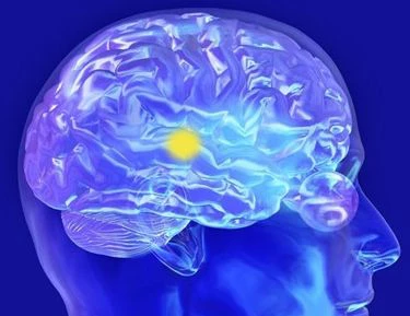 Studies have shown that transforming skin cells into stem cells can treat malignant brain tumor glioblastoma