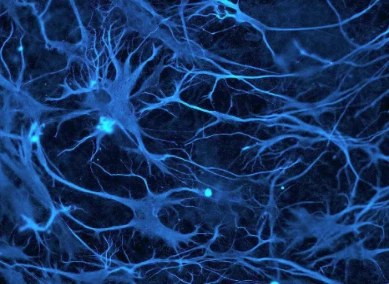 Studies reveal that SIRT6 deficiency can block the differentiation of human neural stem cells into neurons