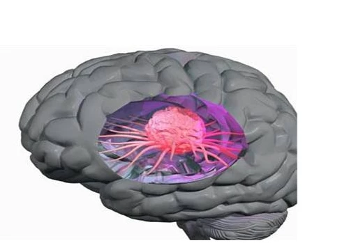 Study finds a new approach to treating MYC-driven neuroblastoma