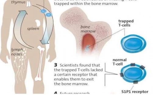 Study to track missing T cells in the body of patients with glioblastoma