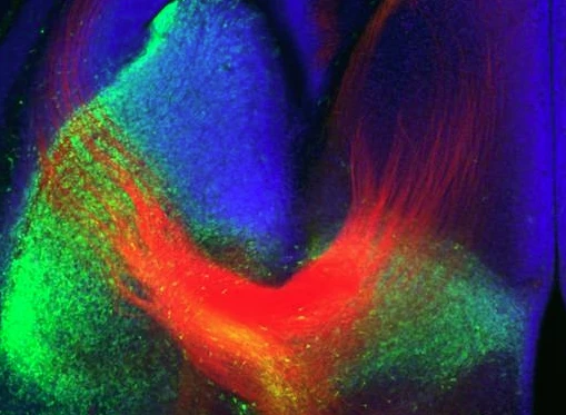 The study found that a three-pronged treatment can trigger axonal regeneration after spinal cord injury